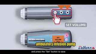 pompe à perfusion ambulatoire